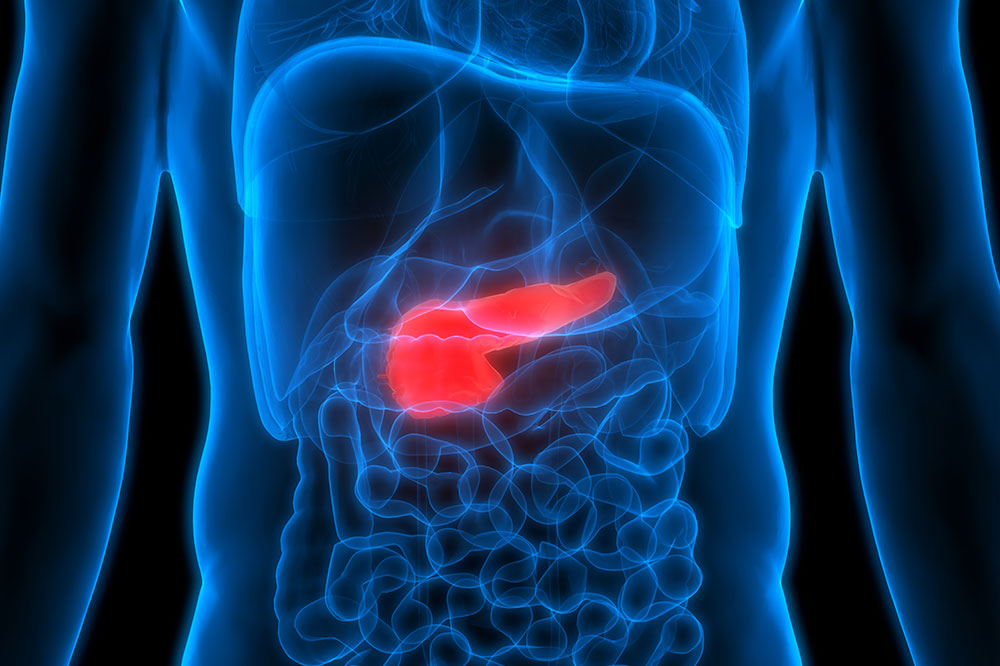 Genetic and Hereditary Risk Factors for Pancreatic Cancer