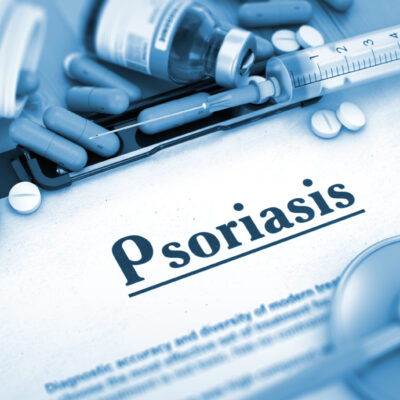 6 Health Conditions Linked to Psoriasis